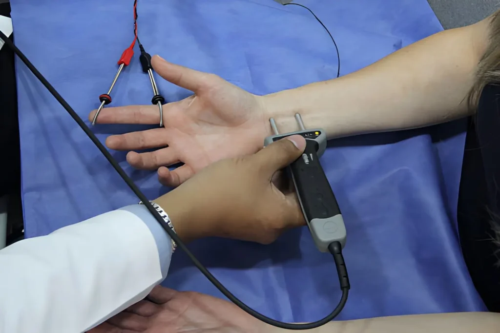 Image showing electromyography (EMG) testing on a patient’s hand and arm using diagnostic electrodes and monitoring equipment