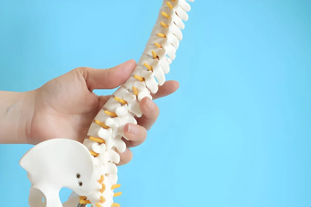  Image of a human spine model showing cervical intervertebral disc herniation and rupture of the fibrous ring.
